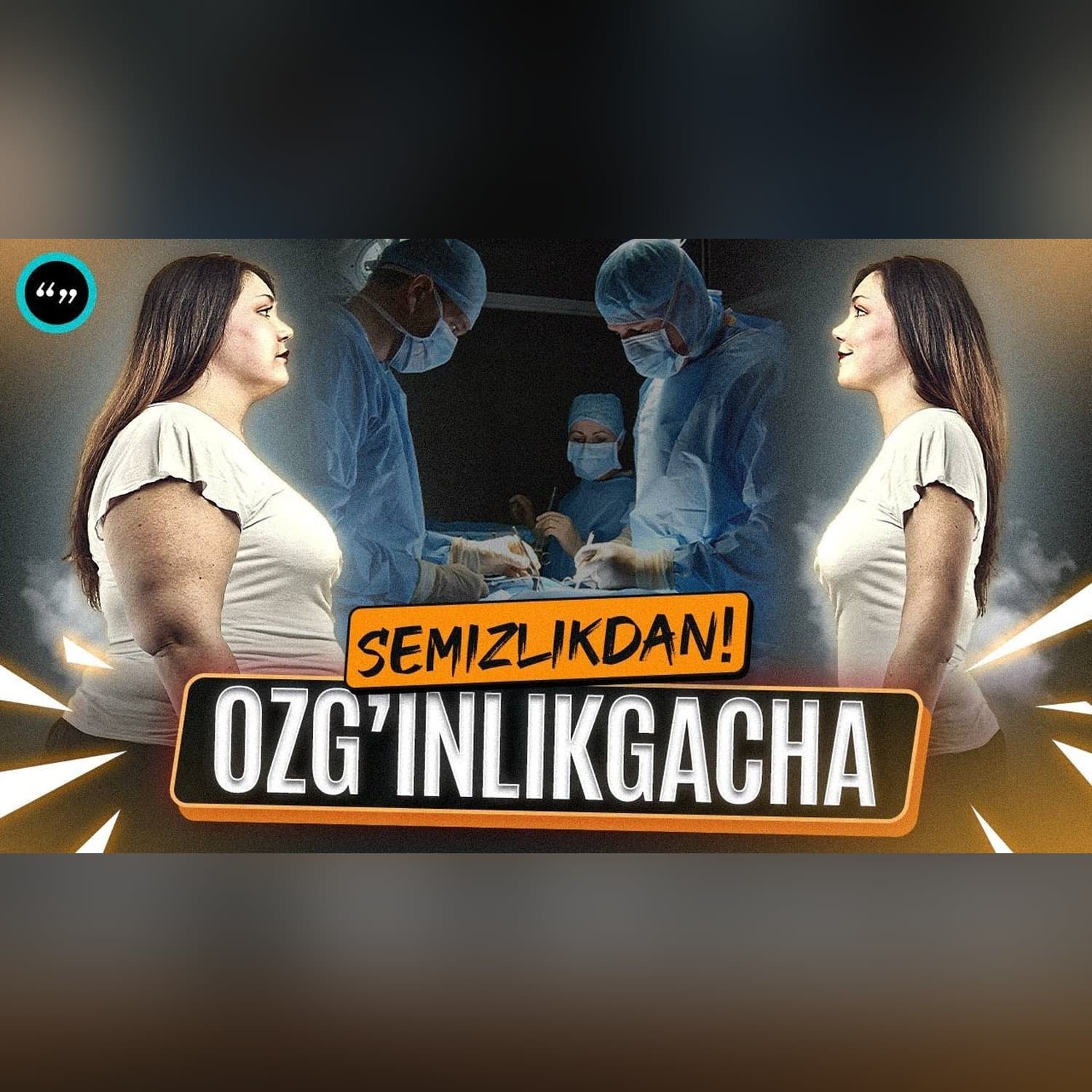 Oshqozonni kesish xavflimi? Oshqozon operatsiyasi va semizlikdan ozg'inlikkacha. /Qo'shtirnoq