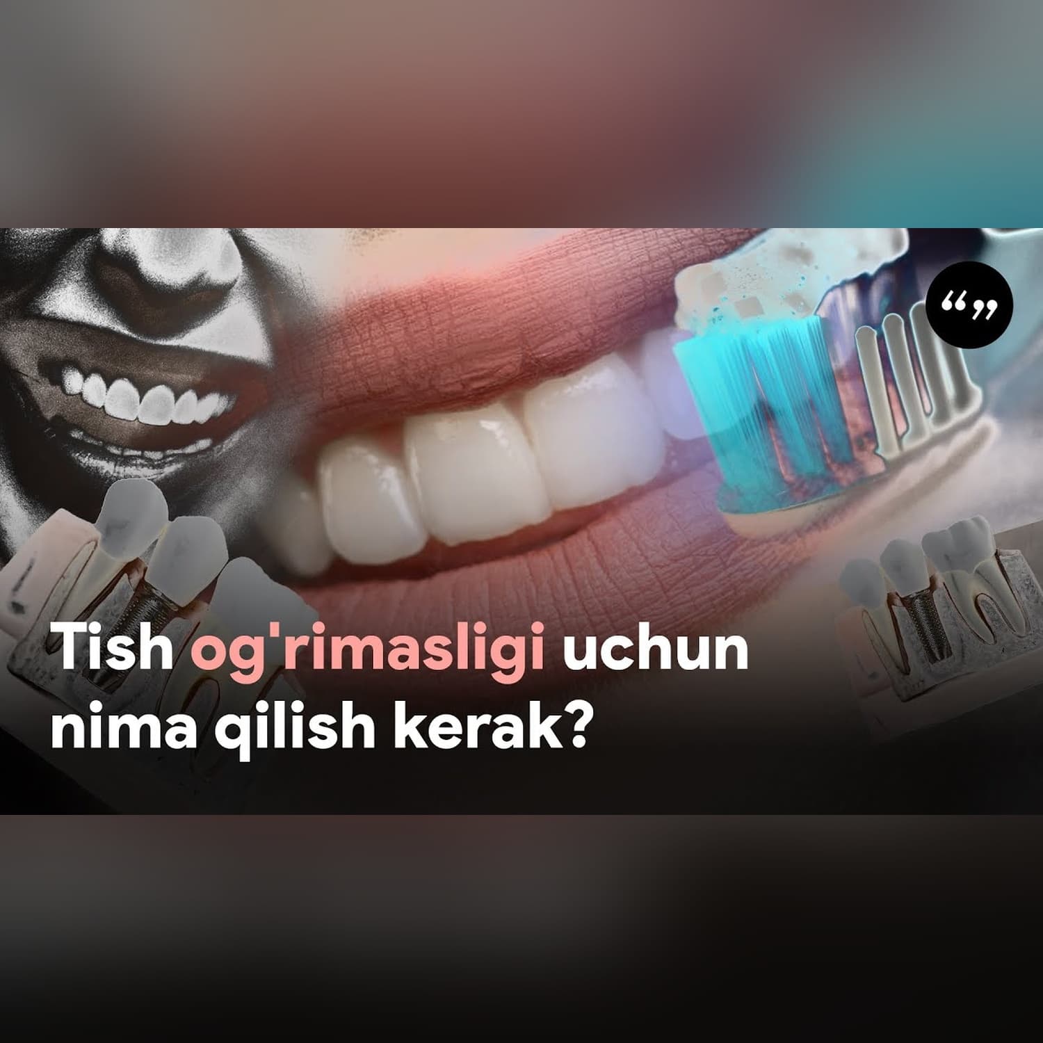 Tish doktoriga nega borish kerak? #jamiyat #tibbiyot #shifokor @QoshtirnoqPodcast