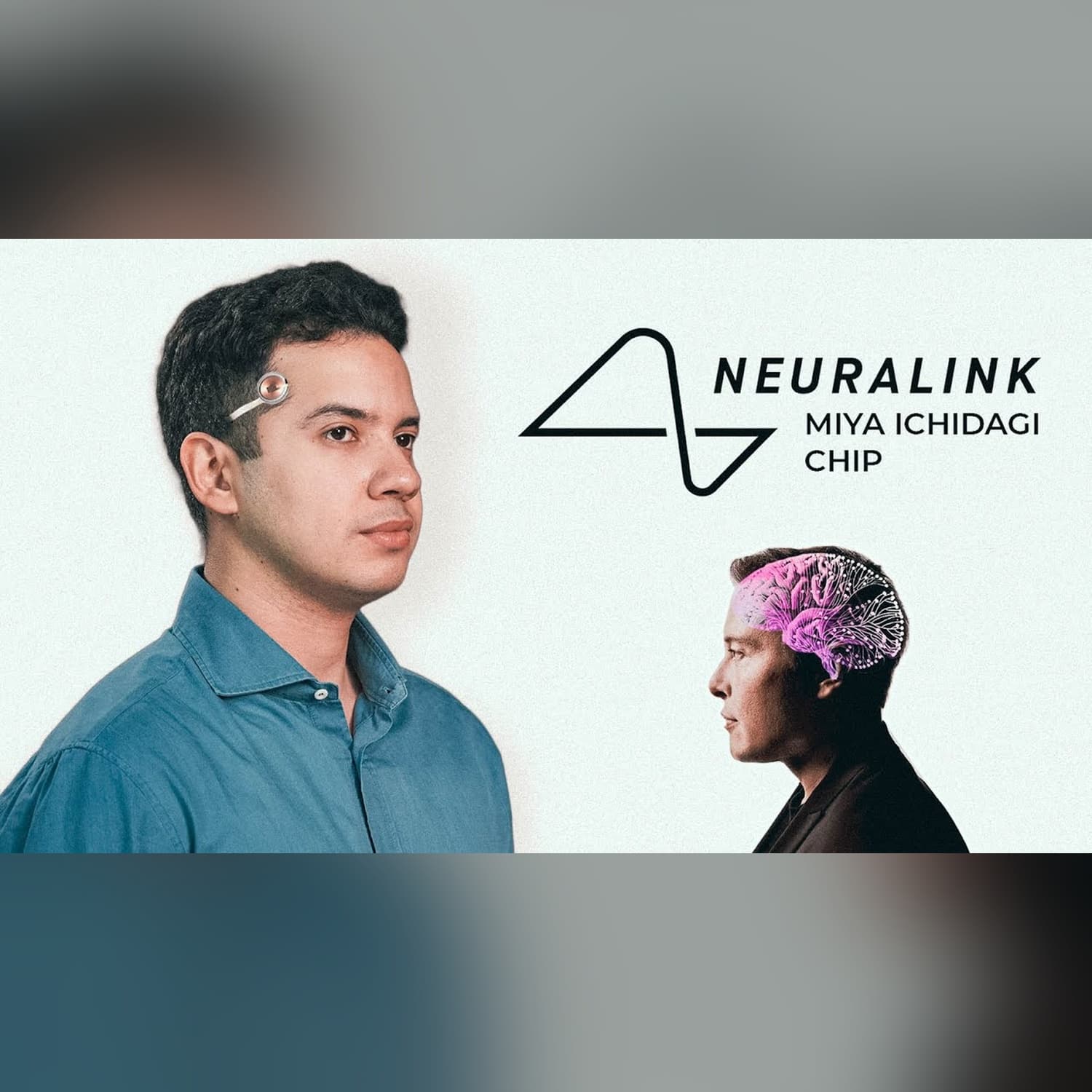 Miya ichidagi chip dunyoni o'zgartirdi. Neuralink nima? | Texnoplov